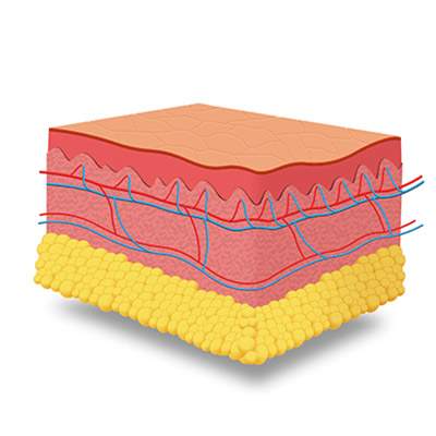 Medilase Pro - Diode ICE Laser met vier golflengten